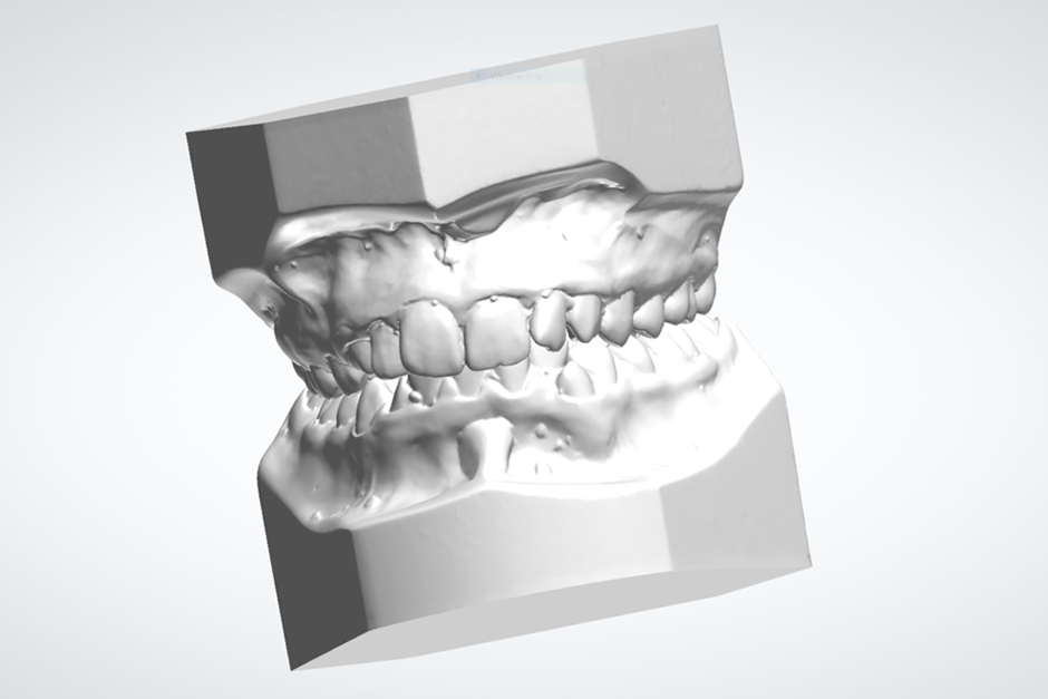 3D Digital Model Scan  *.STL