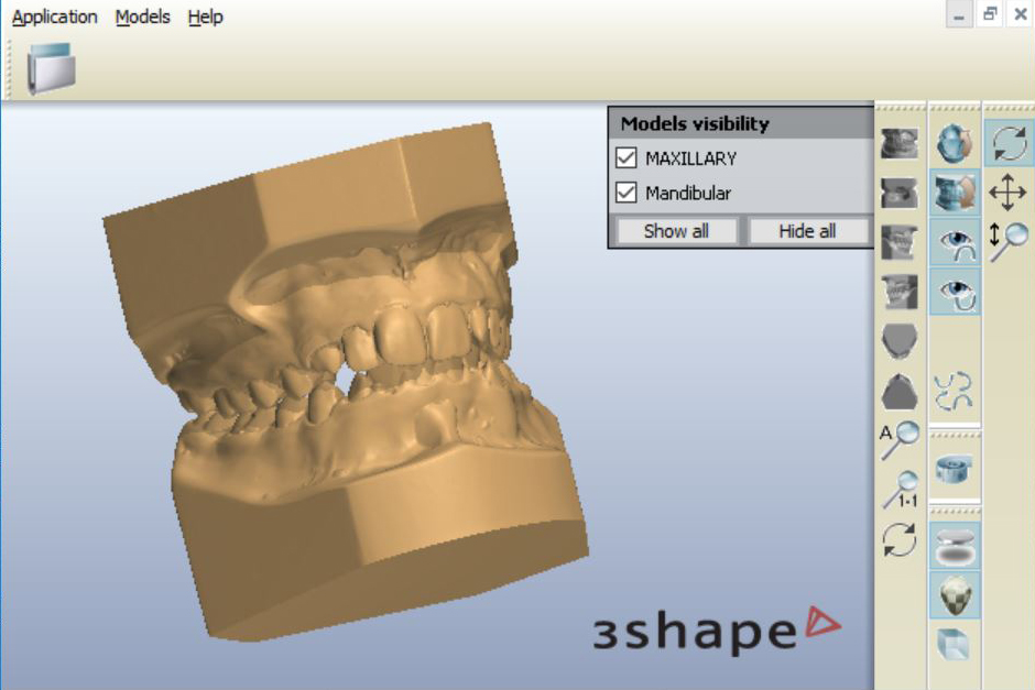 3D Digital Model Scan  *.STL