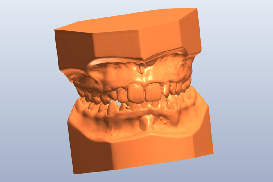 3D Digital Model Scan  *.STL